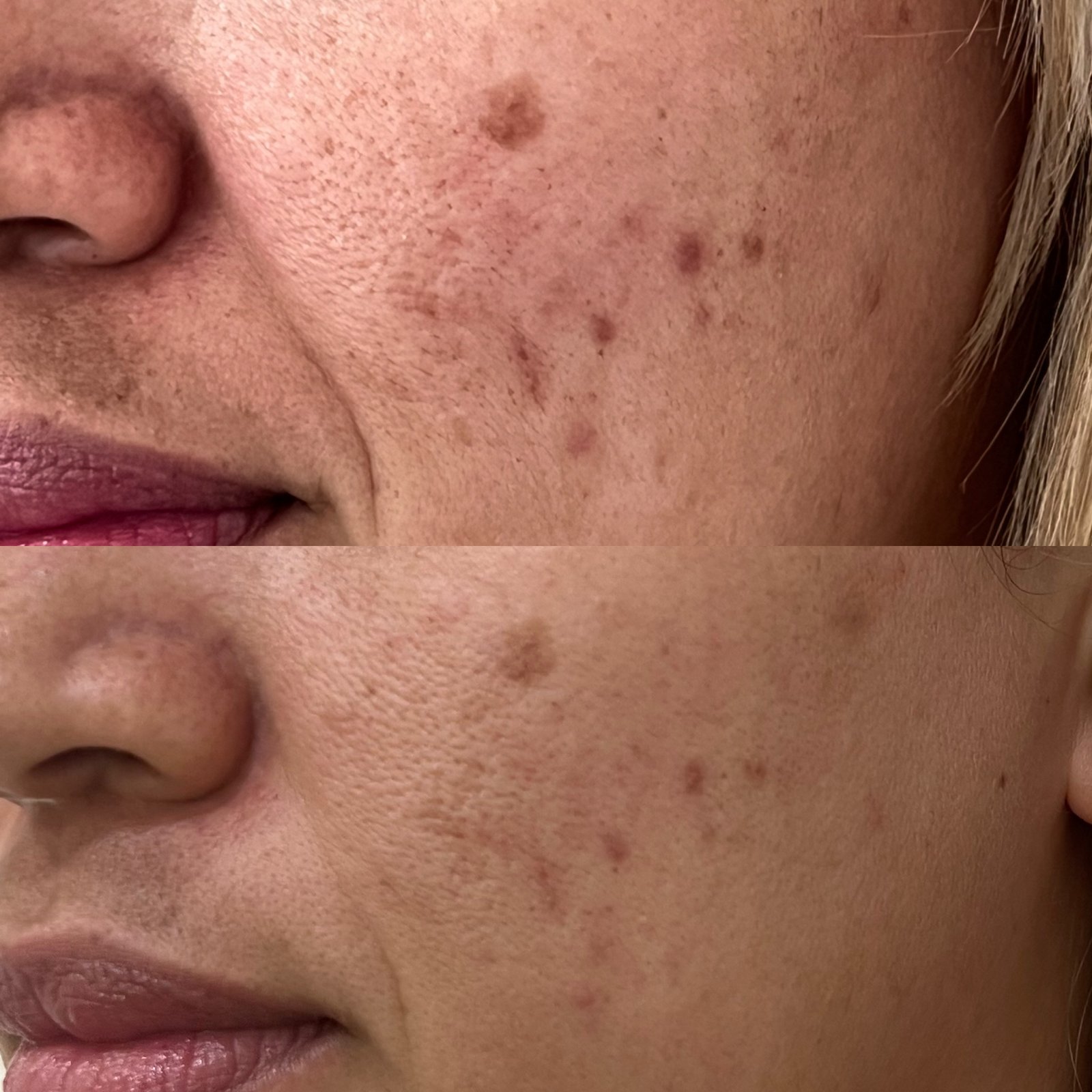 Facial SUMAQ Iluminada (D-cool)